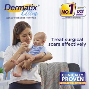 Dermatix Ultra - Advanced Scar Formula Innovative CPX Technology